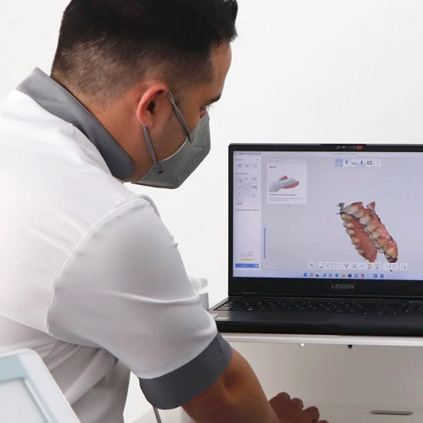 Implantes dentales clínica dental Redován